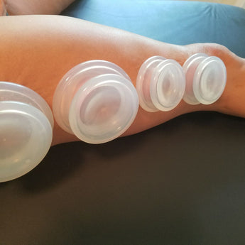 Live Online: Evidence Informed Clinical Cupping - Levels 1-4 - 16 hours