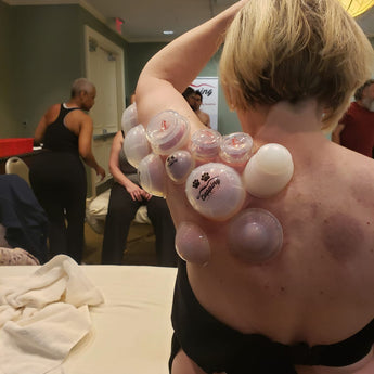 Live Online: Advanced: Cupping with Movement - Level 4